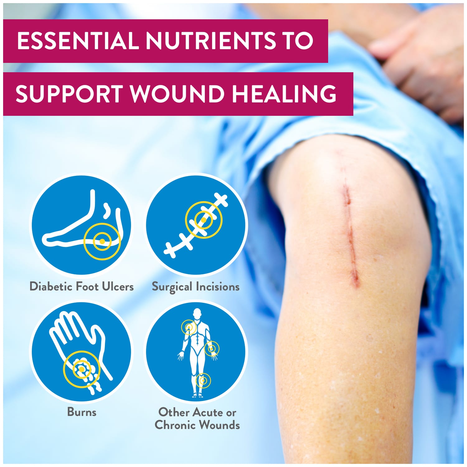Essential nutrients to support wound healing