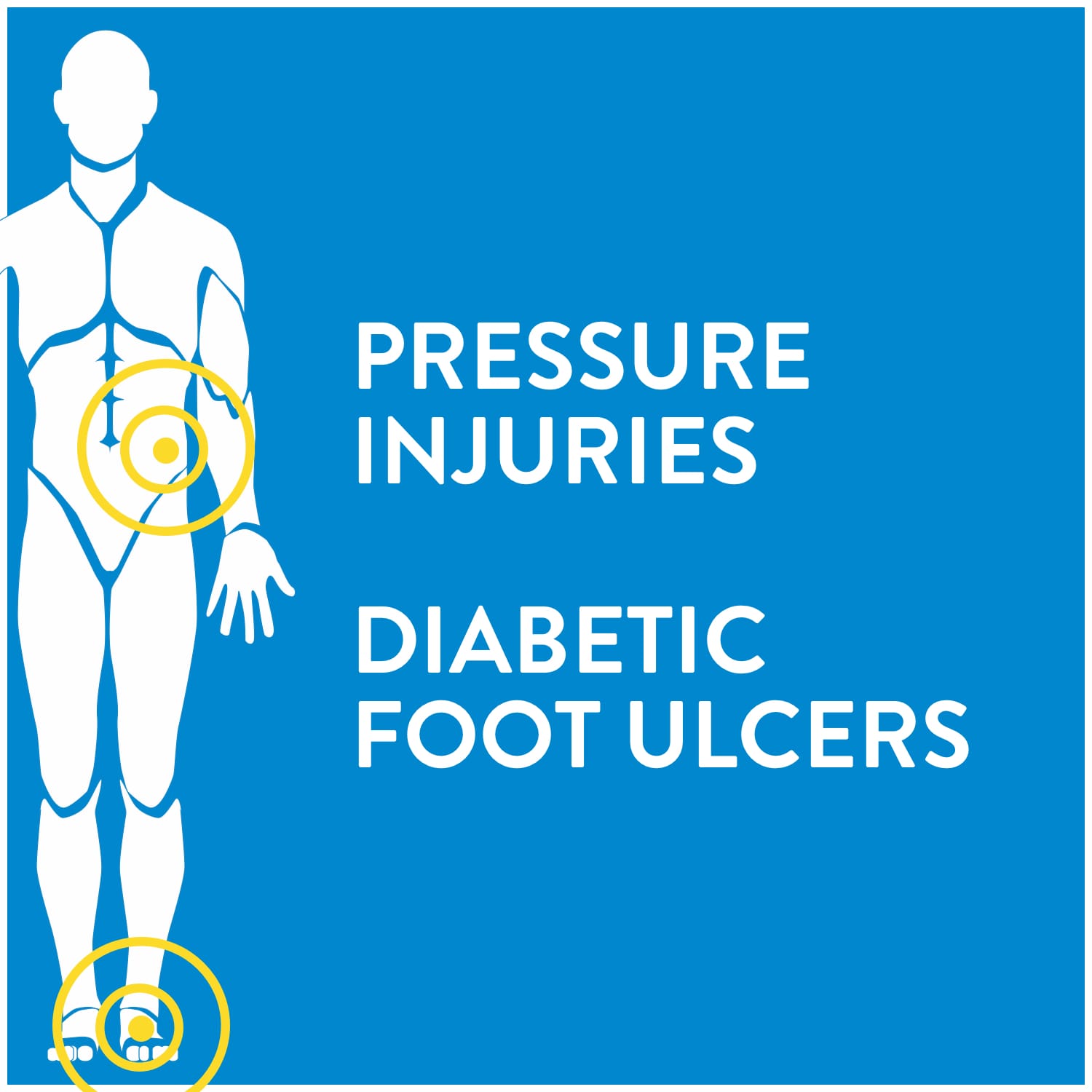 Pressure Injuries and Diabetic Foot Ulcers