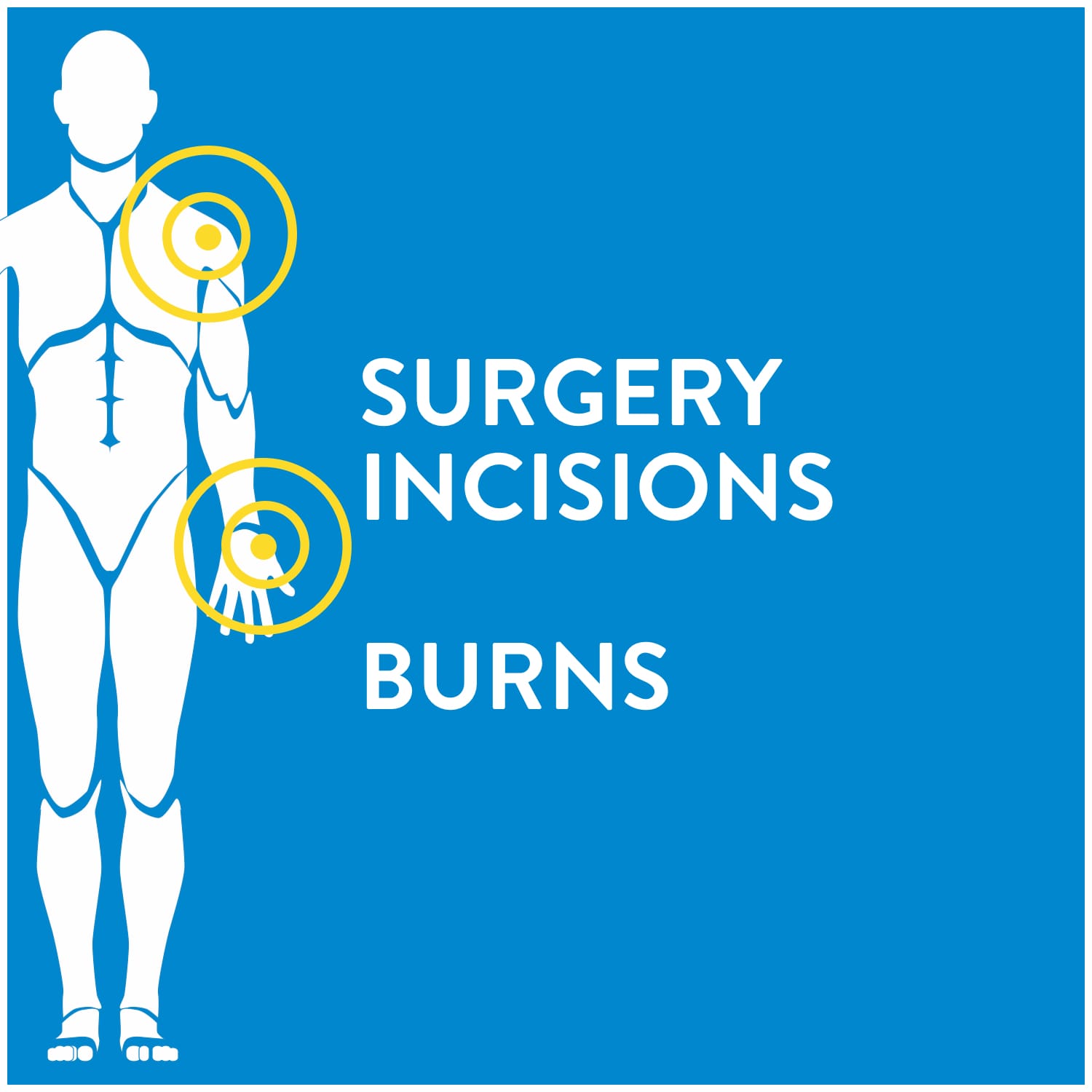 Surgery Incisions and Burns